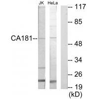 CA181
