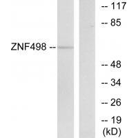 ZNF498
