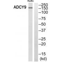 ADCY9