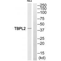 TBPL2
