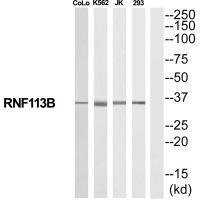 RNF113B