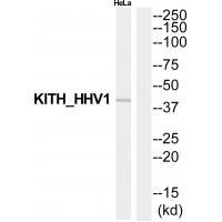 KITH_HHV1