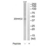 ZDHHC2