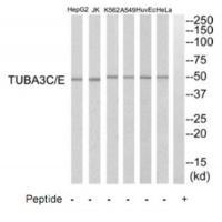 TUBA3C/E