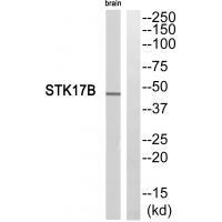 STK17B
