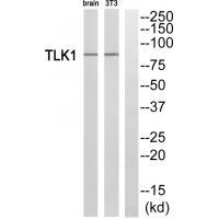 TLK1