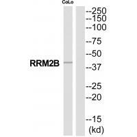 RRM2B