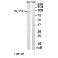 MCPH1
