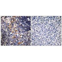 Rabbit Polyclonal Antibody to MCPH1