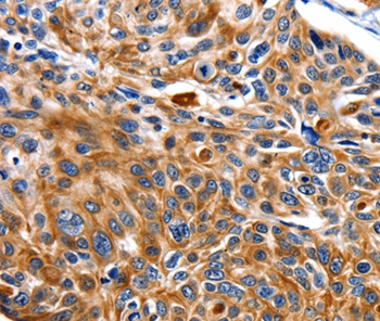 Rabbit Polyclonal Antibody to NEFL