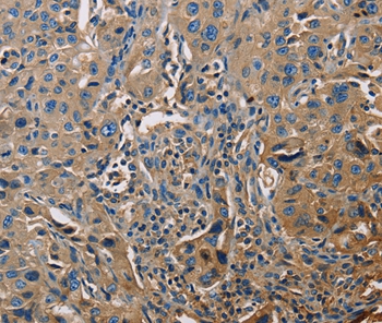 Rabbit Polyclonal Antibody to APOA1
