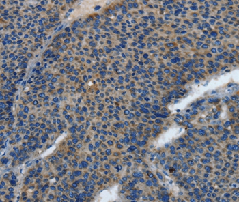 Rabbit Polyclonal Antibody to TLR4