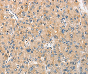 Rabbit Polyclonal Antibody to ANGPTL7
