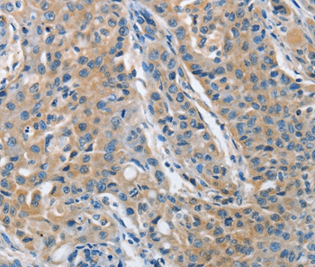 Rabbit Polyclonal Antibody to TNFSF13