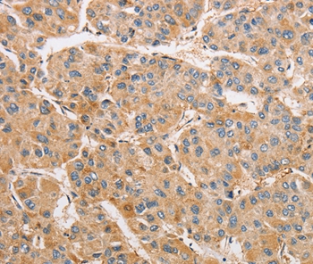 Rabbit Polyclonal Antibody to ARMCX1