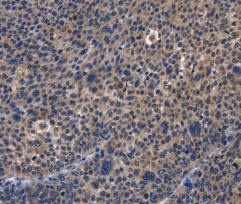 Rabbit Polyclonal Antibody to PRKCD