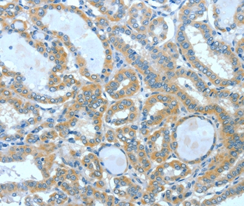 Rabbit Polyclonal Antibody to SPHK2