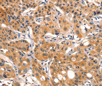 Rabbit Polyclonal Antibody to AIM2