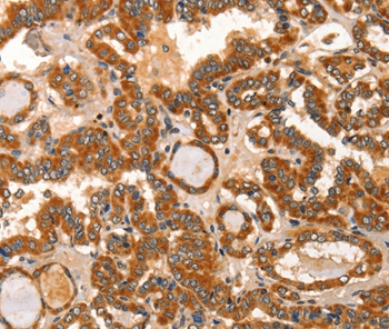 Rabbit Polyclonal Antibody to IKZF3
