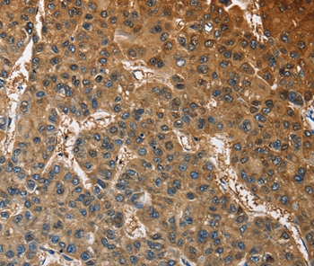 Rabbit Polyclonal Antibody to ATP1B2