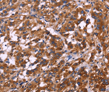 Rabbit Polyclonal Antibody to KIR2DL3/1/4/S4