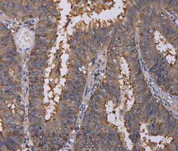 Rabbit Polyclonal Antibody to REG3G