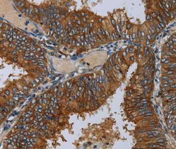 Rabbit Polyclonal Antibody to MIER2