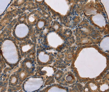 Rabbit Polyclonal Antibody to SCGB2A1