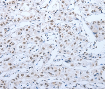 Rabbit Polyclonal Antibody to ACIN1
