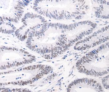 Rabbit Polyclonal Antibody to JUND