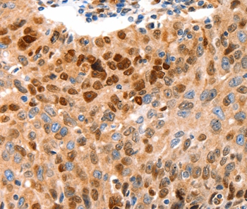 Rabbit Polyclonal Antibody to GRM4
