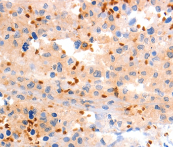 Rabbit Polyclonal Antibody to GRM8