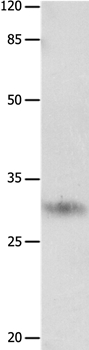 KLK2