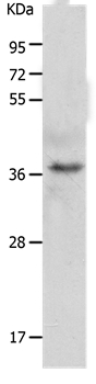 C1QTNF5