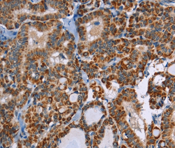 ABCB1