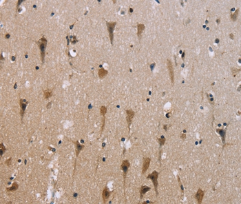 Rabbit Polyclonal Antibody to ABCB1