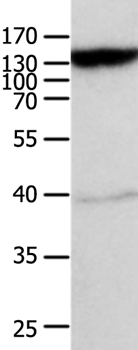 ABCC5