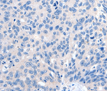 Rabbit Polyclonal Antibody to GRIN2D