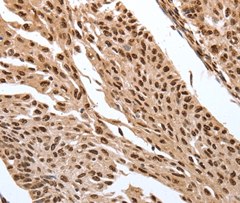 Rabbit Polyclonal Antibody to SRF
