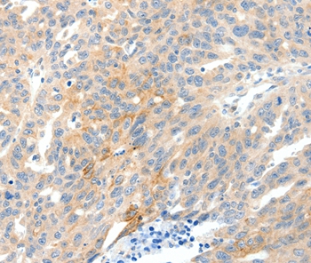 Rabbit Polyclonal Antibody to NTRK1