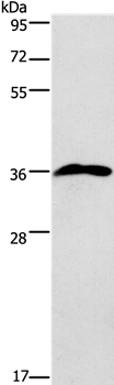 PRPS1/2/1L1