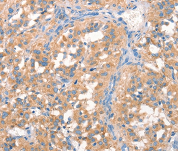 Rabbit Polyclonal Antibody to PRPS1/2/1L1