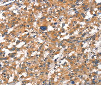 CDH5