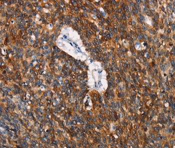 Rabbit Polyclonal Antibody to CD68