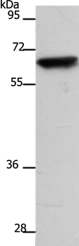 SLC22A8