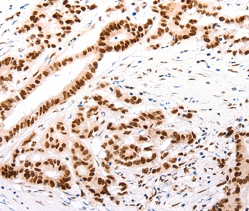 CASP9 (active)