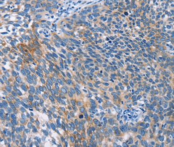 Rabbit Polyclonal Antibody to AHR