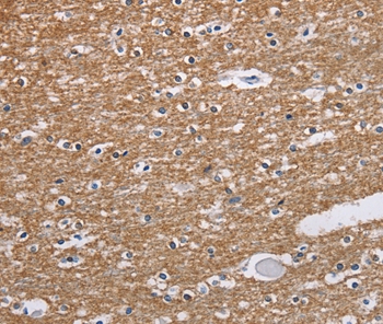 Rabbit Polyclonal Antibody to NCR2