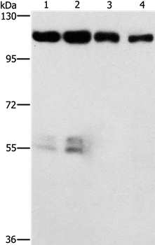 CDK11A/CDK11B