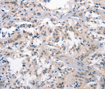 CRHR1